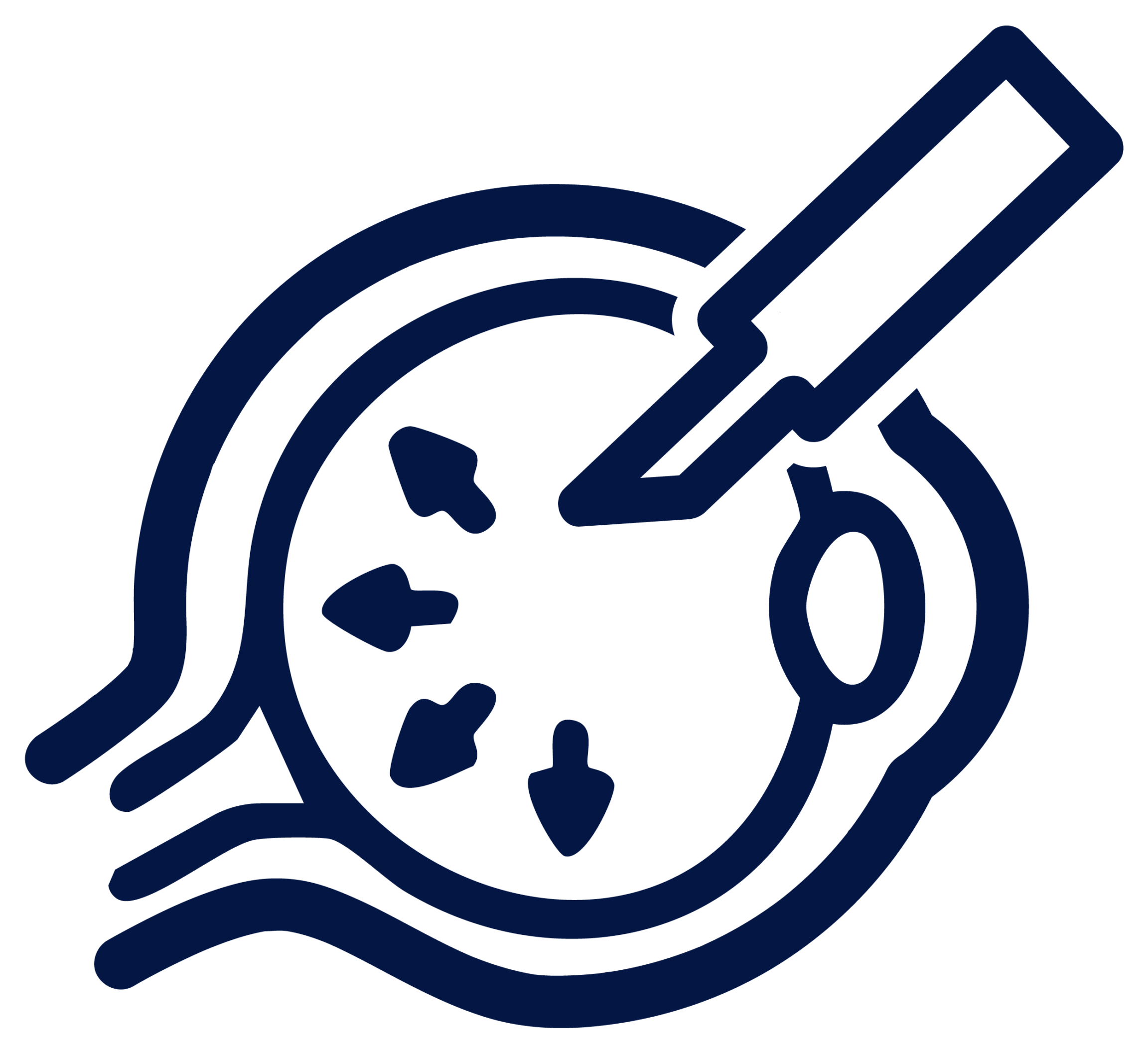 Glaucoma Scaled E1770225322865 | Oftalmología Boutique - OPTISA